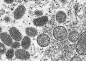 Qu’est-ce que la variole du singe, ce nouveau virus qui inquiète les autorités sanitaires en Europe ?