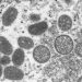 Qu’est-ce que la variole du singe, ce nouveau virus qui inquiète les autorités sanitaires en Europe ?