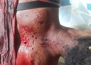 Dékoué : Drame] Une jeune fille fusillée tard la nuit, des suspects interpellés par la police