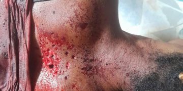 Dékoué : Drame] Une jeune fille fusillée tard la nuit, des suspects interpellés par la police