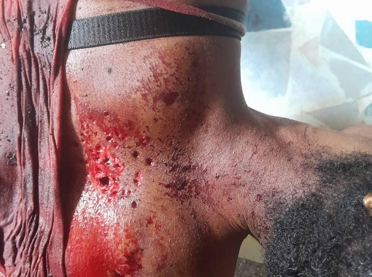 Dékoué : Drame] Une jeune fille fusillée tard la nuit, des suspects interpellés par la police