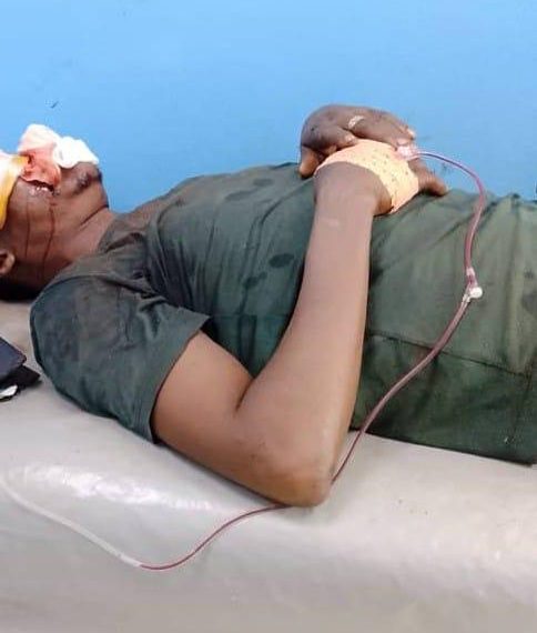 Guiglo : Un artiste-comédien victime d’un grave accident de circulation